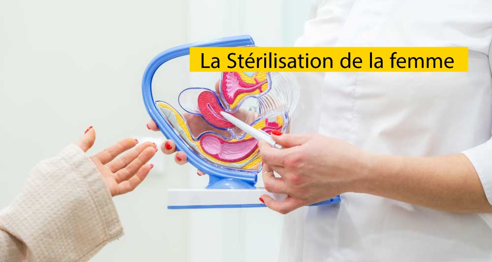 La Stérilisation de la femme 