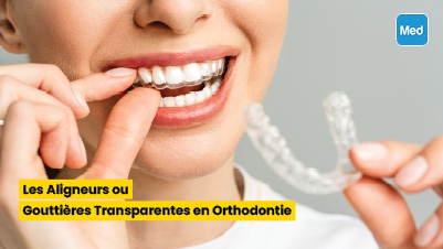 Les Aligneurs ou Gouttières Transparentes en Orthodontie