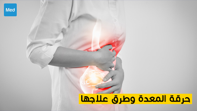 حرقة المعدة وطرق علاجها